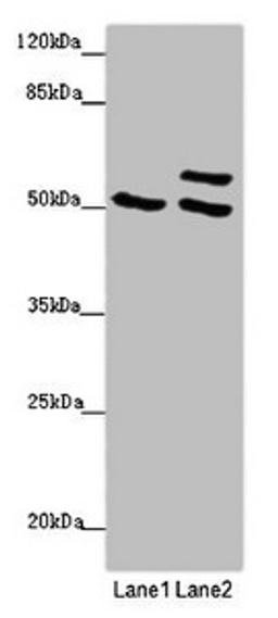 Western blot. All lanes: TUBB4A antibody at 2 ug/ml. Lane 1: 293T whole cell lysate. Lane 2: Hela whole cell lysate. Secondary. Goat polyclonal to rabbit IgG at 1/10000 dilution. Predicted band size: 50 kDa. Observed band size: 50, 58 kDa.