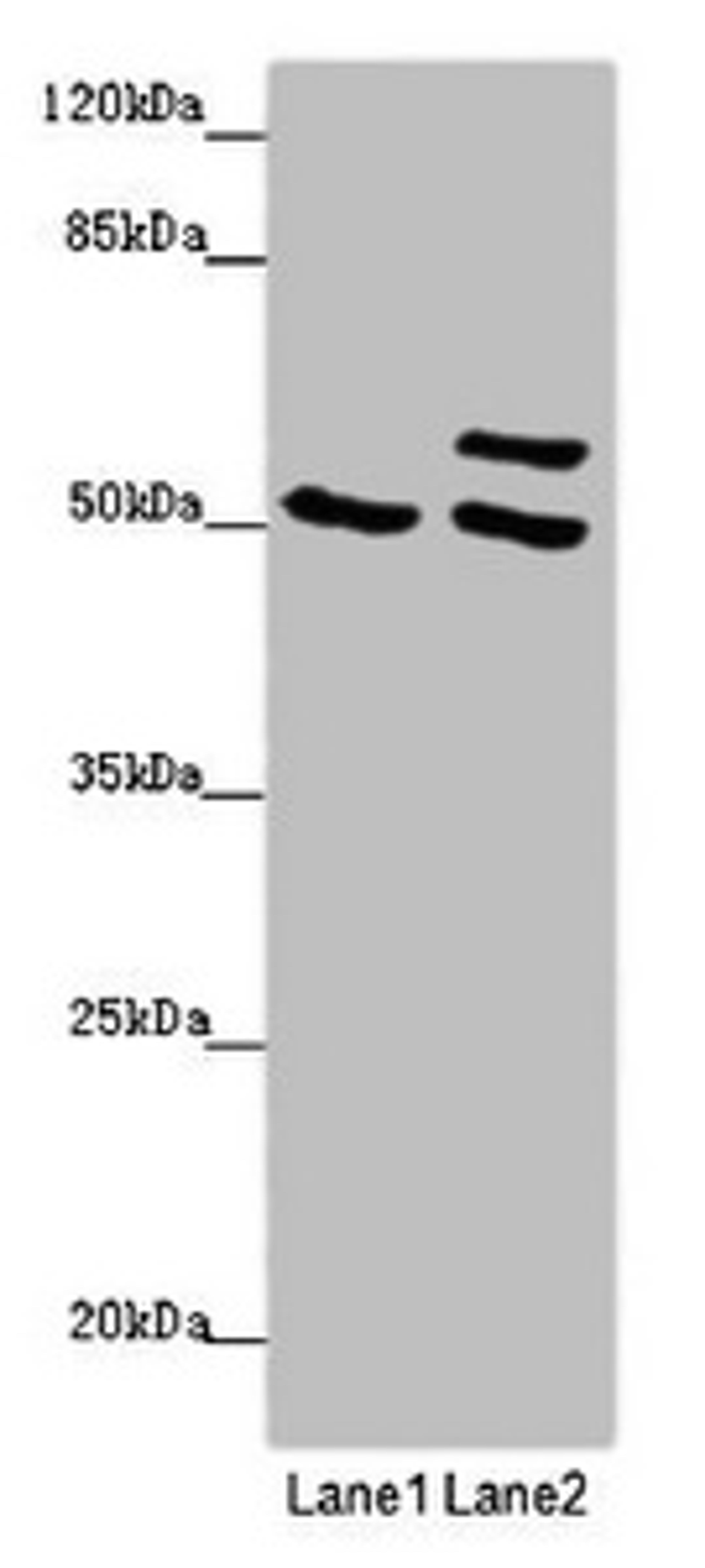 Western blot. All lanes: TUBB4A antibody at 2 ug/ml. Lane 1: 293T whole cell lysate. Lane 2: Hela whole cell lysate. Secondary. Goat polyclonal to rabbit IgG at 1/10000 dilution. Predicted band size: 50 kDa. Observed band size: 50, 58 kDa.