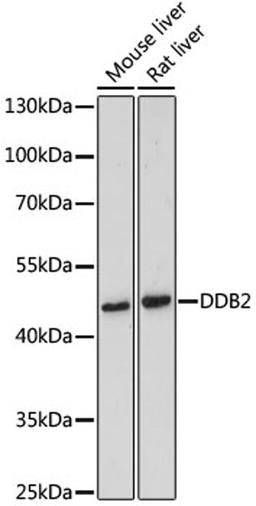 Western blot - DDB2 antibody (A1848)