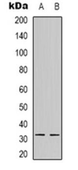 Western blot analysis of NFYB expression in A549 (Lane 1), HEK293T (Lane 2) whole cell lysates using NFYB antibody