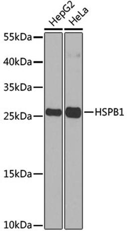 Western blot - HSPB1 antibody (A0240)