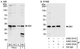 Detection of human EB1 by western blot and immunoprecipitation.