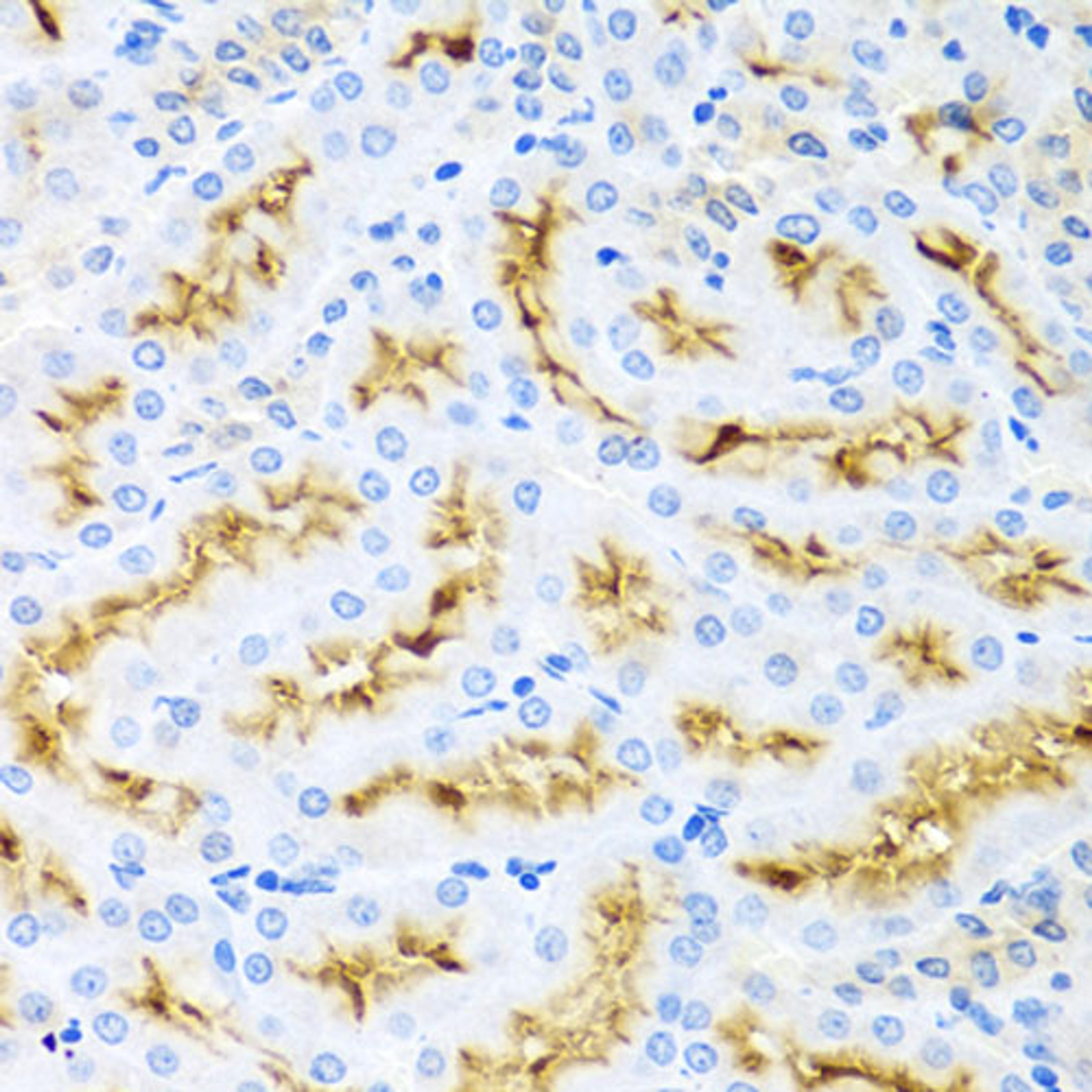 Immunohistochemistry  - CCL22 antibody (A1966)