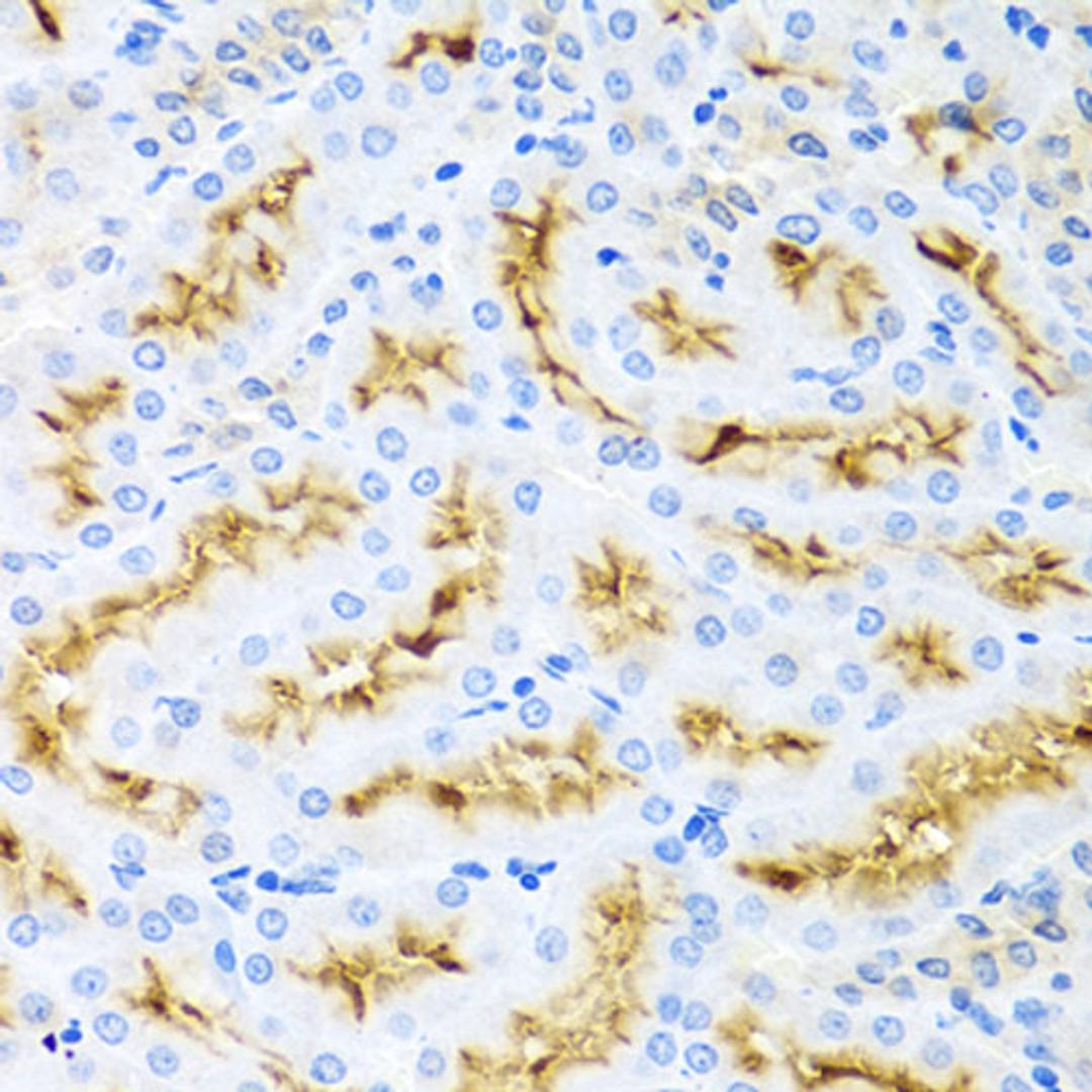 Immunohistochemistry - CCL22 antibody (A1966)