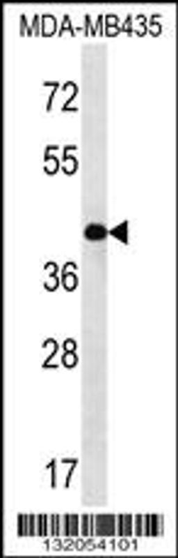 Western blot analysis in MDA-MB435 cell line lysates (35ug/lane).