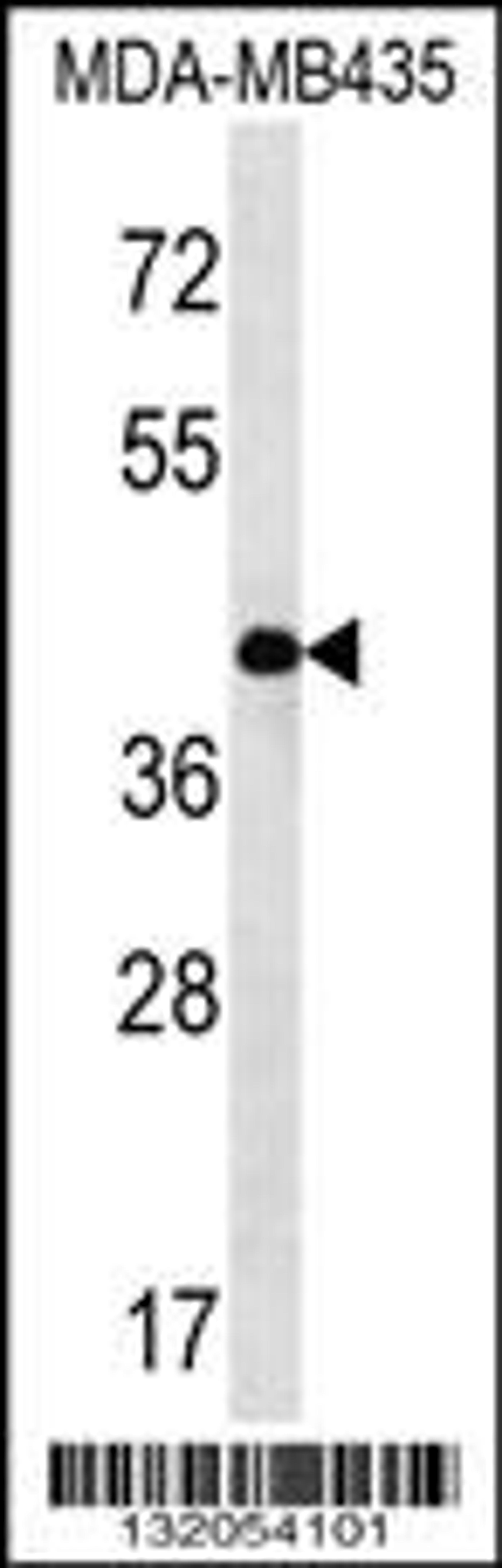 Western blot analysis in MDA-MB435 cell line lysates (35ug/lane).