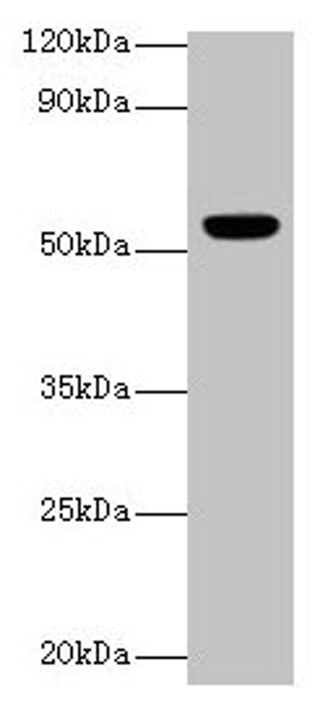 Western blot. All lanes: CHRNA1 antibody at 2µg/ml + Rat skeletal muscle tissue. Secondary. Goat polyclonal to rabbit IgG at 1/10000 dilution. Predicted band size: 55, 52 kDa. Observed band size: 55 kDa