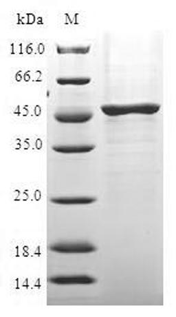 (Tris-Glycine gel) Discontinuous SDS-PAGE (reduced) with 5% enrichment gel and 15% separation gel.