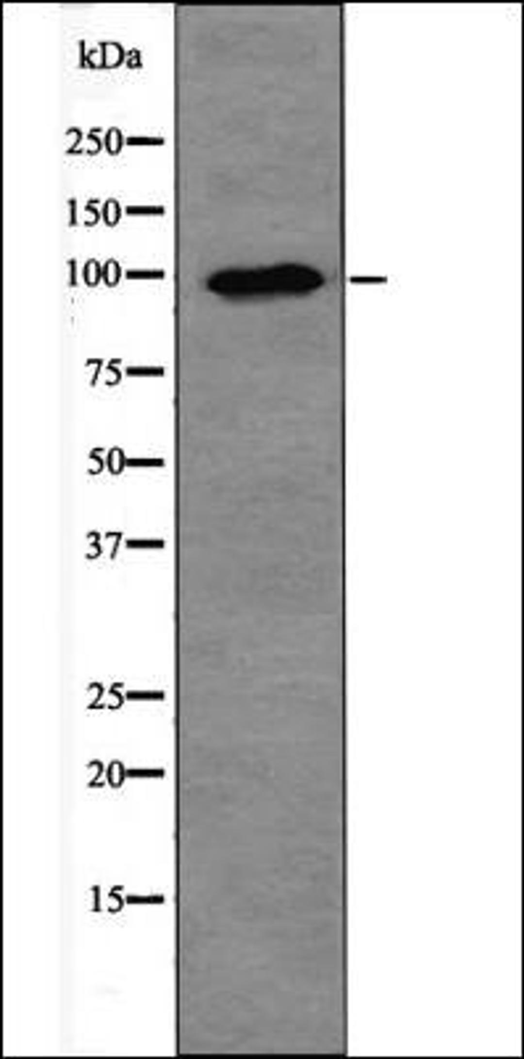 Western blot analysis of PMA treated Jurkat whole cell lysates using PKD2 -Phospho-Ser812- antibody