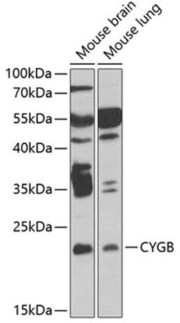 Western blot - CYGB antibody (A6488)