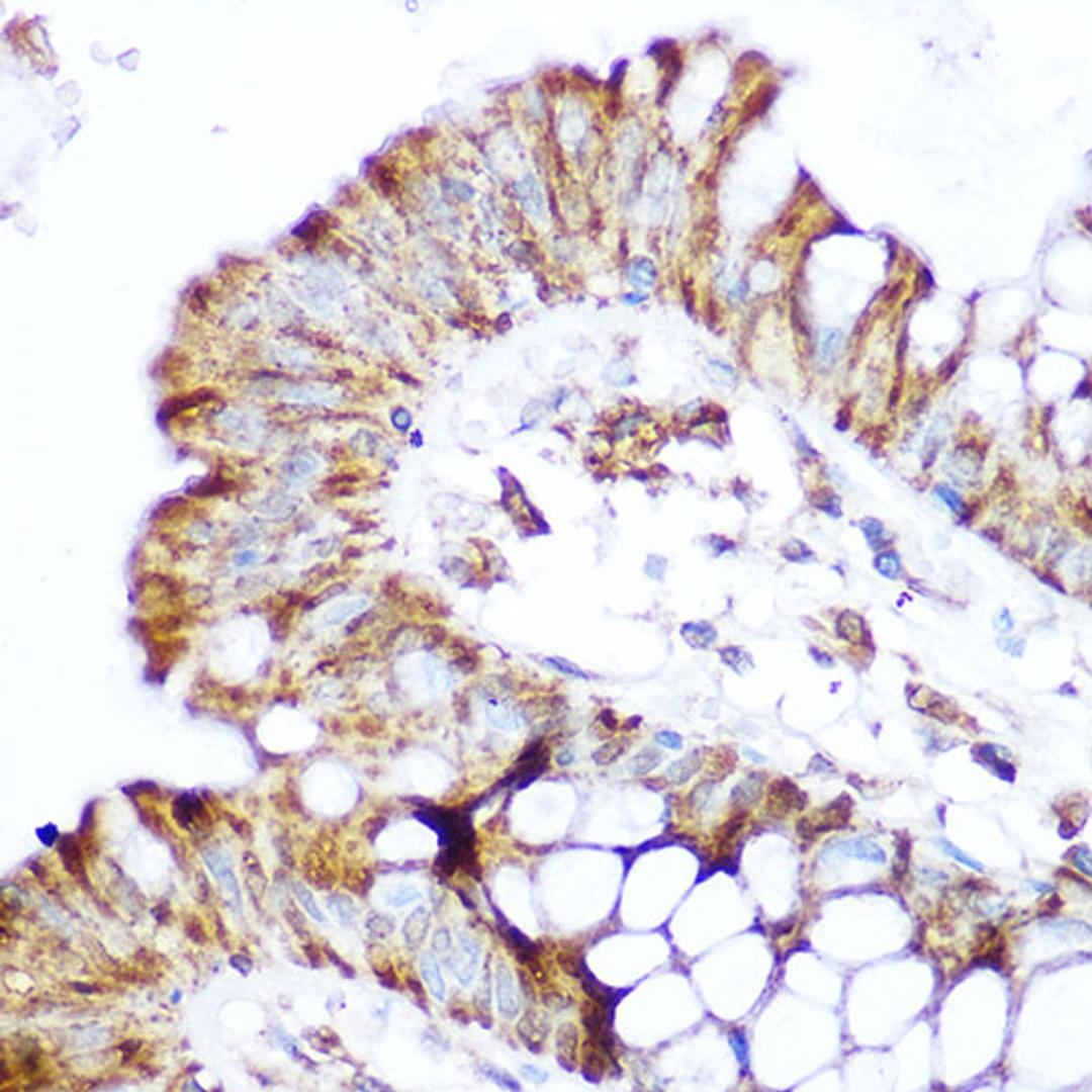 Immunohistochemistry  - NOD2 Rabbit pAb (A15992)