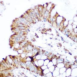 Immunohistochemistry - NOD2 Rabbit pAb (A15992)