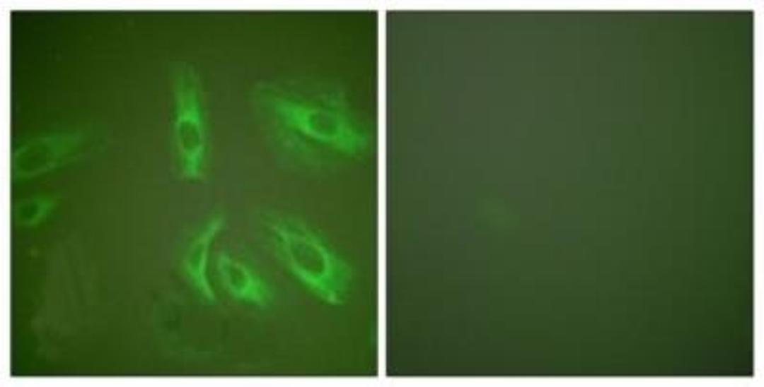 Immunocytochemistry/Immunofluorescence: Gastrin peptide Antibody [NBP1-67574] - Analysis of HeLa cells, using . The picture on the right is treated with the synthesized peptide.