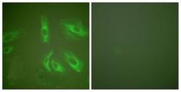 Immunocytochemistry/Immunofluorescence: Gastrin peptide Antibody [NBP1-67574] - Analysis of HeLa cells, using . The picture on the right is treated with the synthesized peptide.