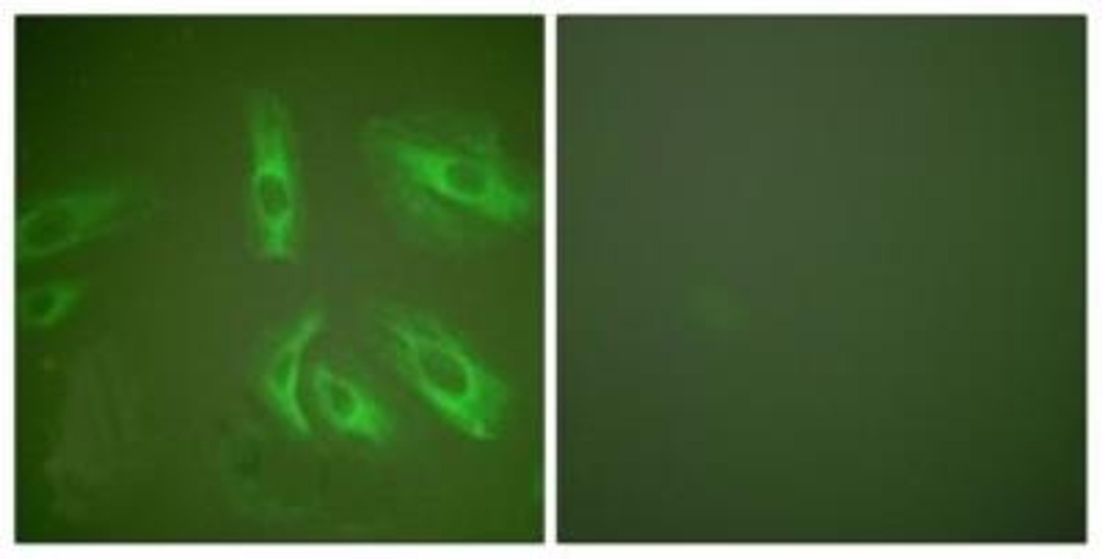 Immunocytochemistry/Immunofluorescence: Gastrin peptide Antibody [NBP1-67574] - Analysis of HeLa cells, using . The picture on the right is treated with the synthesized peptide.