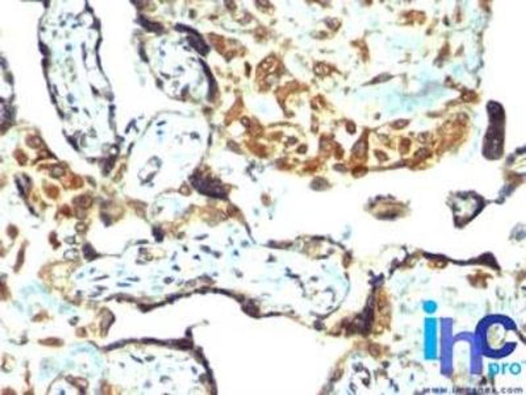 Immunohistochemistry-Paraffin: TIMP-3 Antibody [NBP2-29478] - Formalin-fixed, paraffin-embedded human placenta stained with TIMP-3 antibody (1:200), peroxidase-conjugate and DAB chromogen.