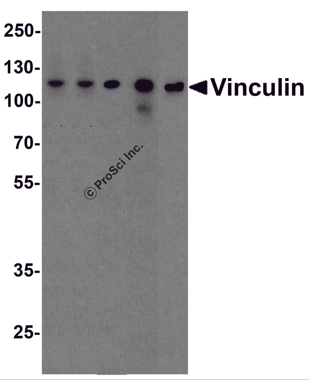 Western blot analysis of Vinculin in A431, Daudi, Jurkat, Raji, and THP-1 cell lysate with Vinculin antibody at 1 μg/ml.