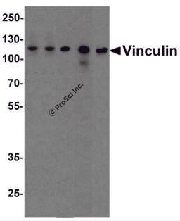 Western blot analysis of Vinculin in A431, Daudi, Jurkat, Raji, and THP-1 cell lysate with Vinculin antibody at 1 μg/ml.