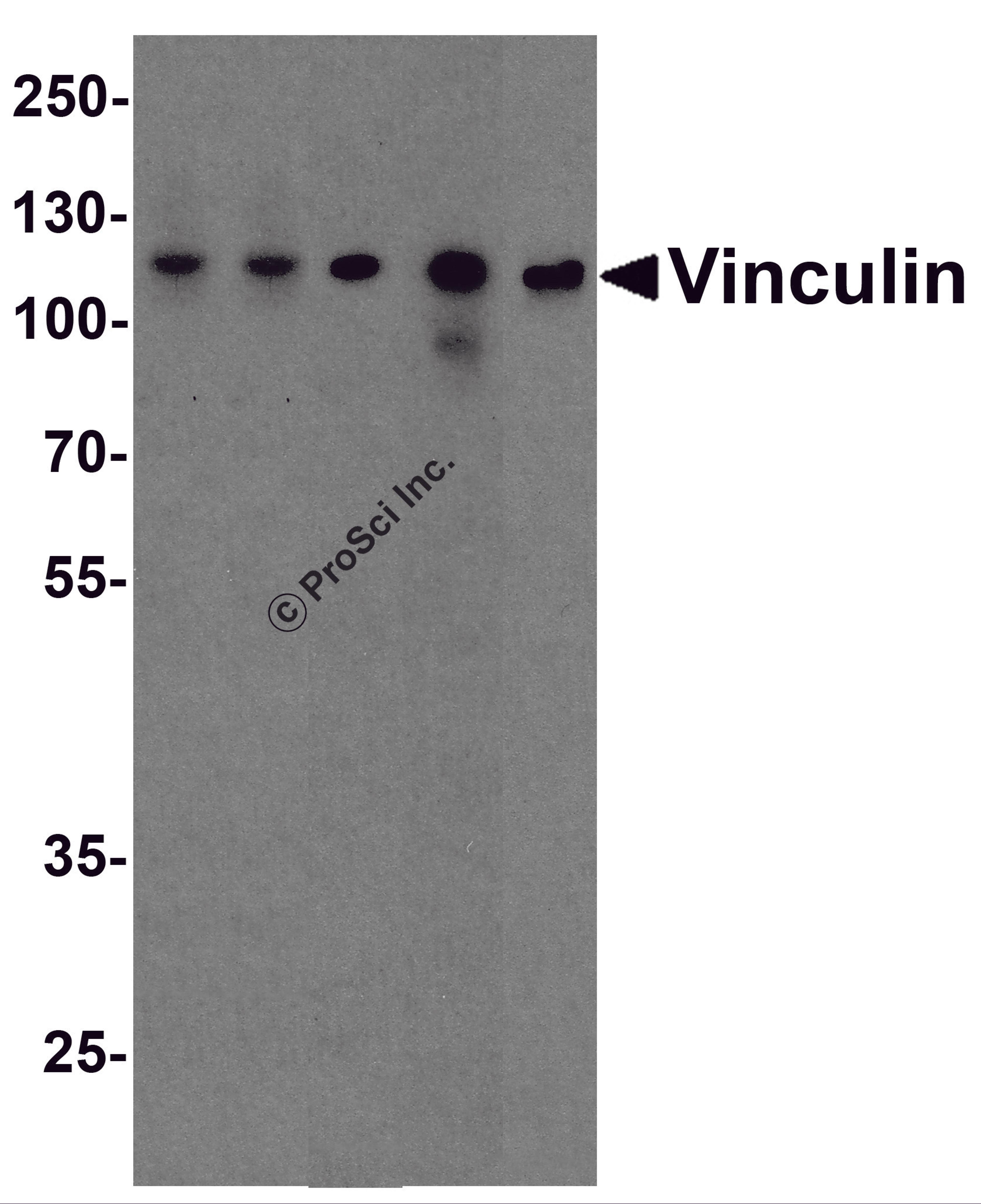 Western blot analysis of Vinculin in A431, Daudi, Jurkat, Raji, and THP-1 cell lysate with Vinculin antibody at 1 μg/ml.