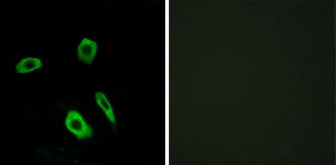 Immunofluorescence analysis of LOVO cells using EDG7 antibody.