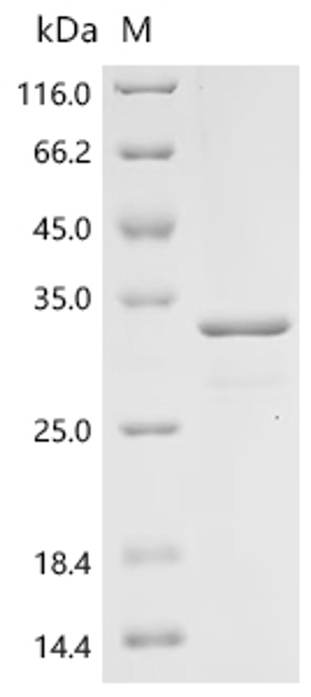 (Tris-Glycine gel) Discontinuous SDS-PAGE (reduced) with 5% enrichment gel and 15% separation gel.