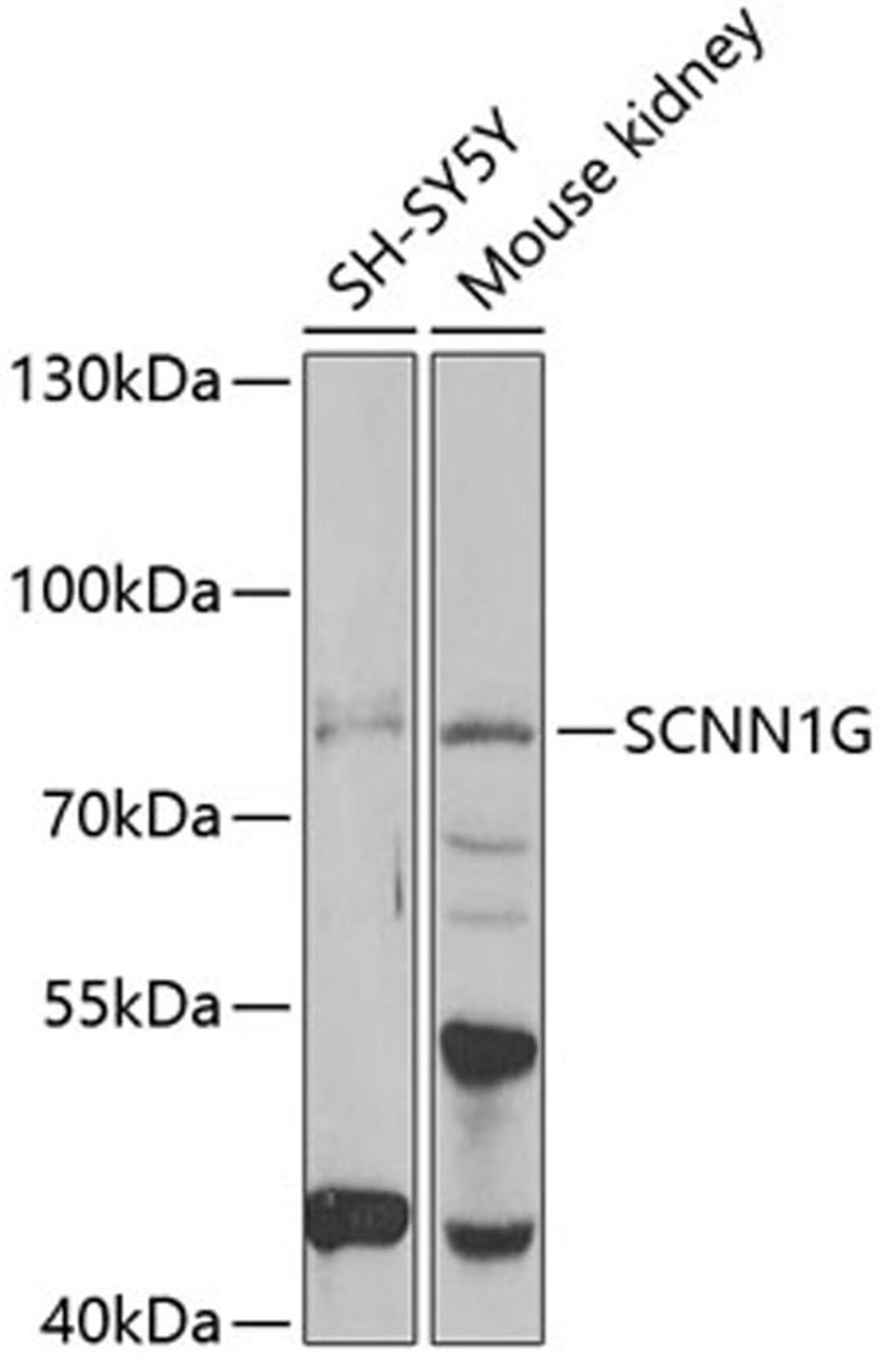 Western blot - SCNN1G antibody (A6126)