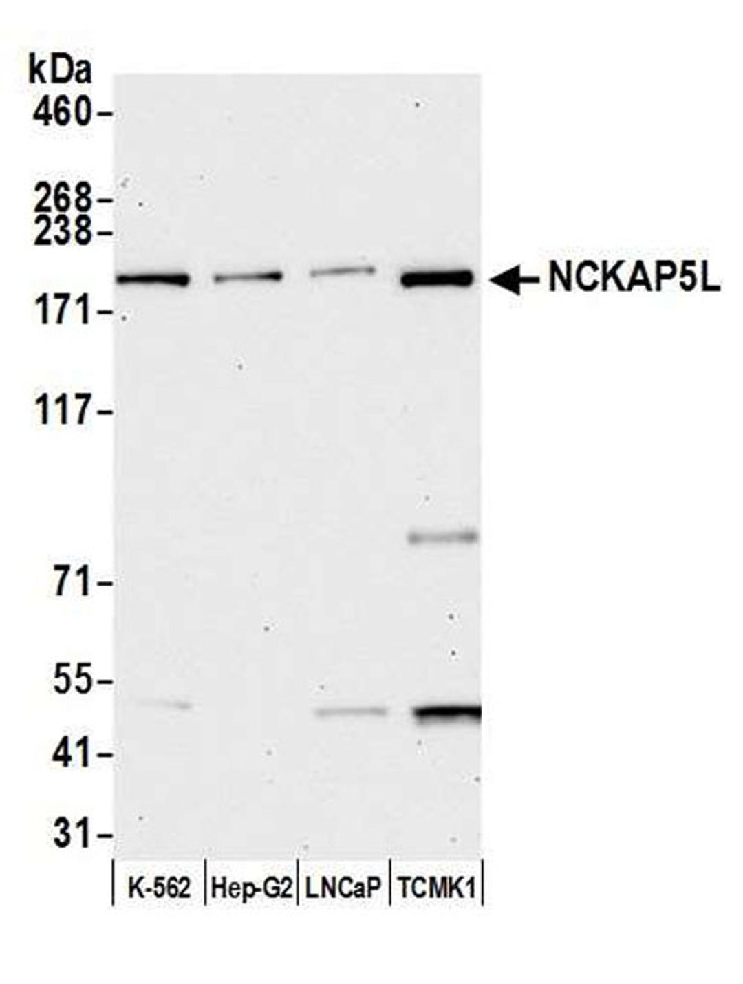 Detection of human and mouse NCKAP5L by WB.