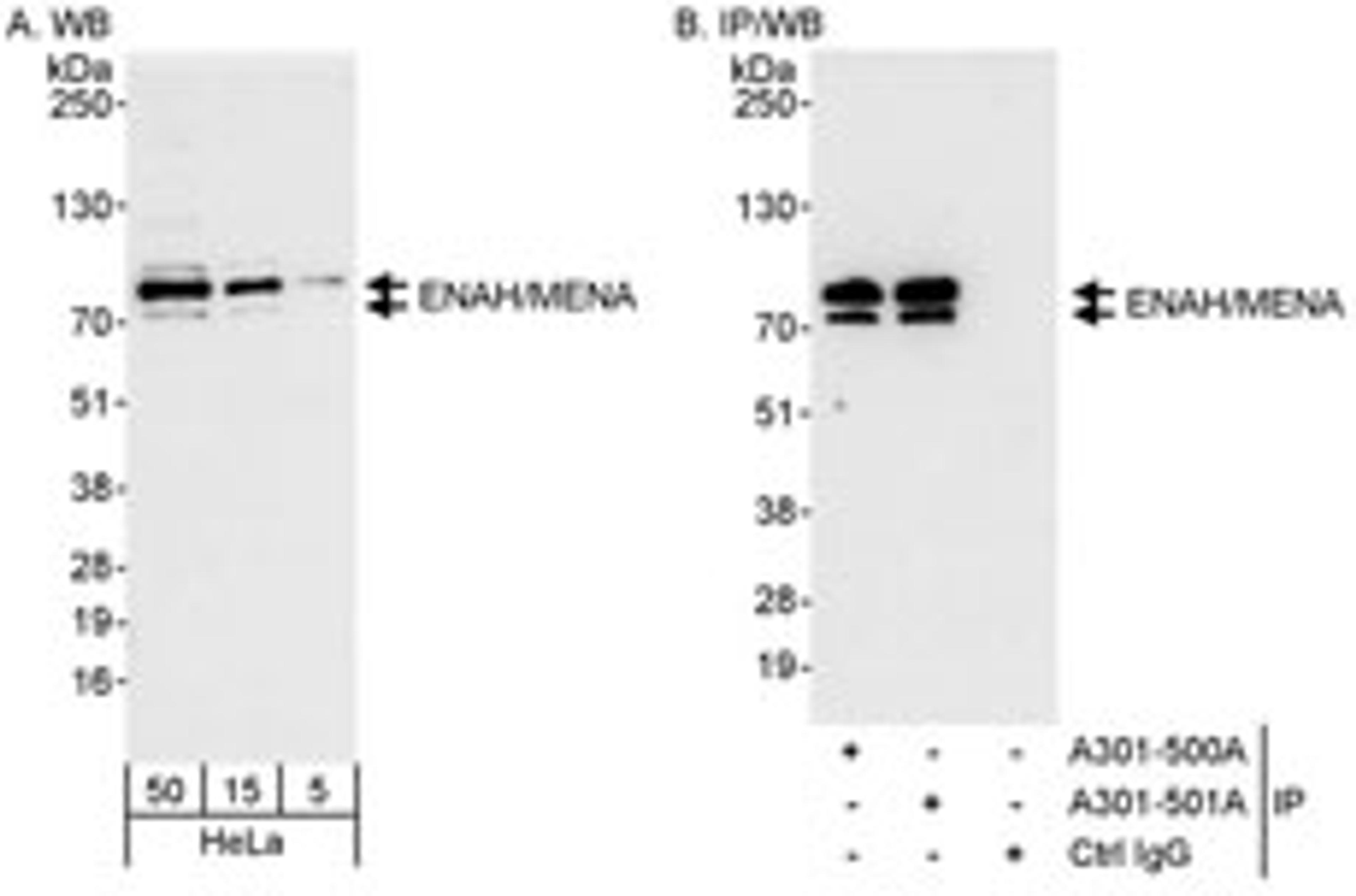 Detection of human ENAH/MENA by western blot and immunoprecipitation.