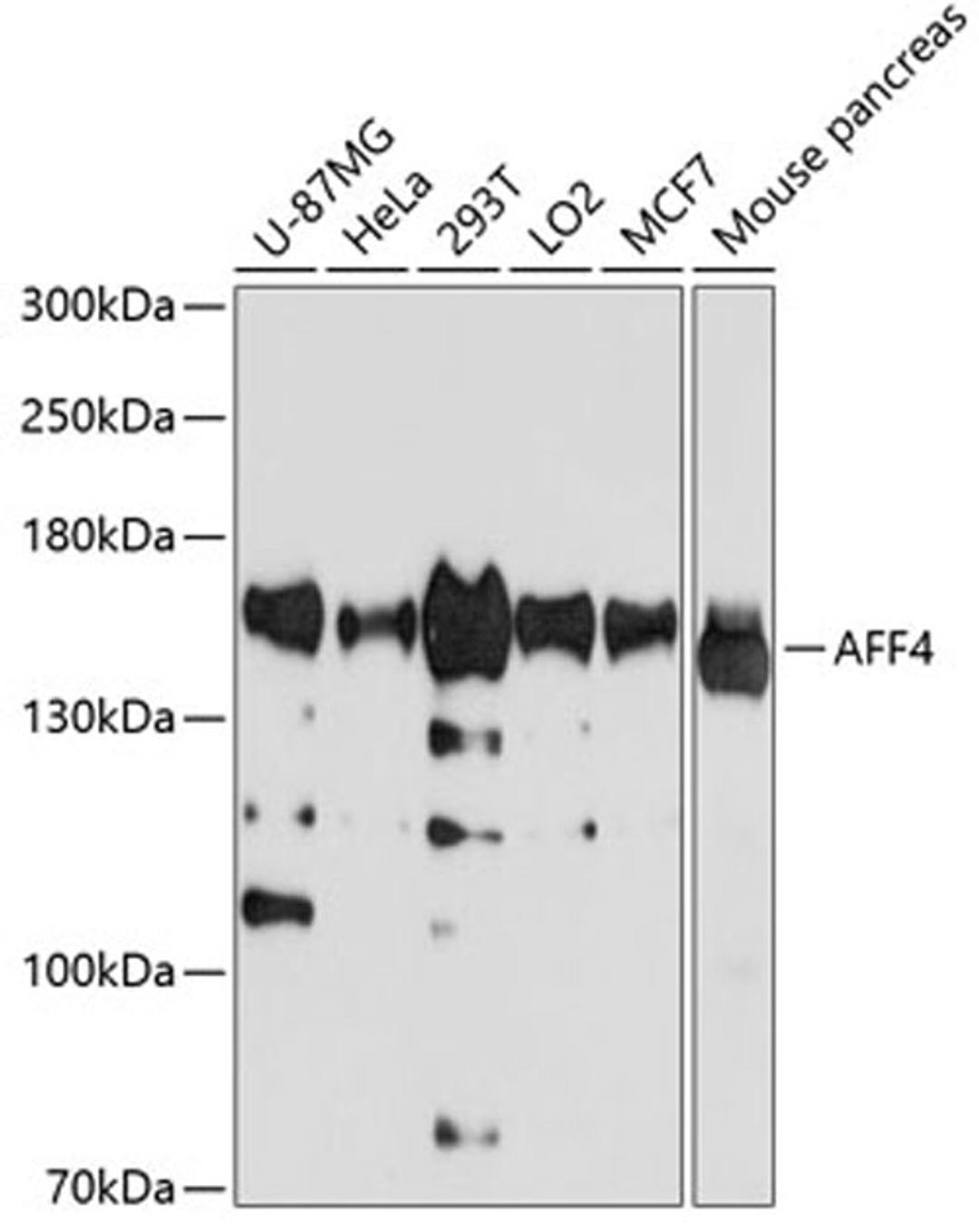 Western blot - AFF4 antibody (A4644)