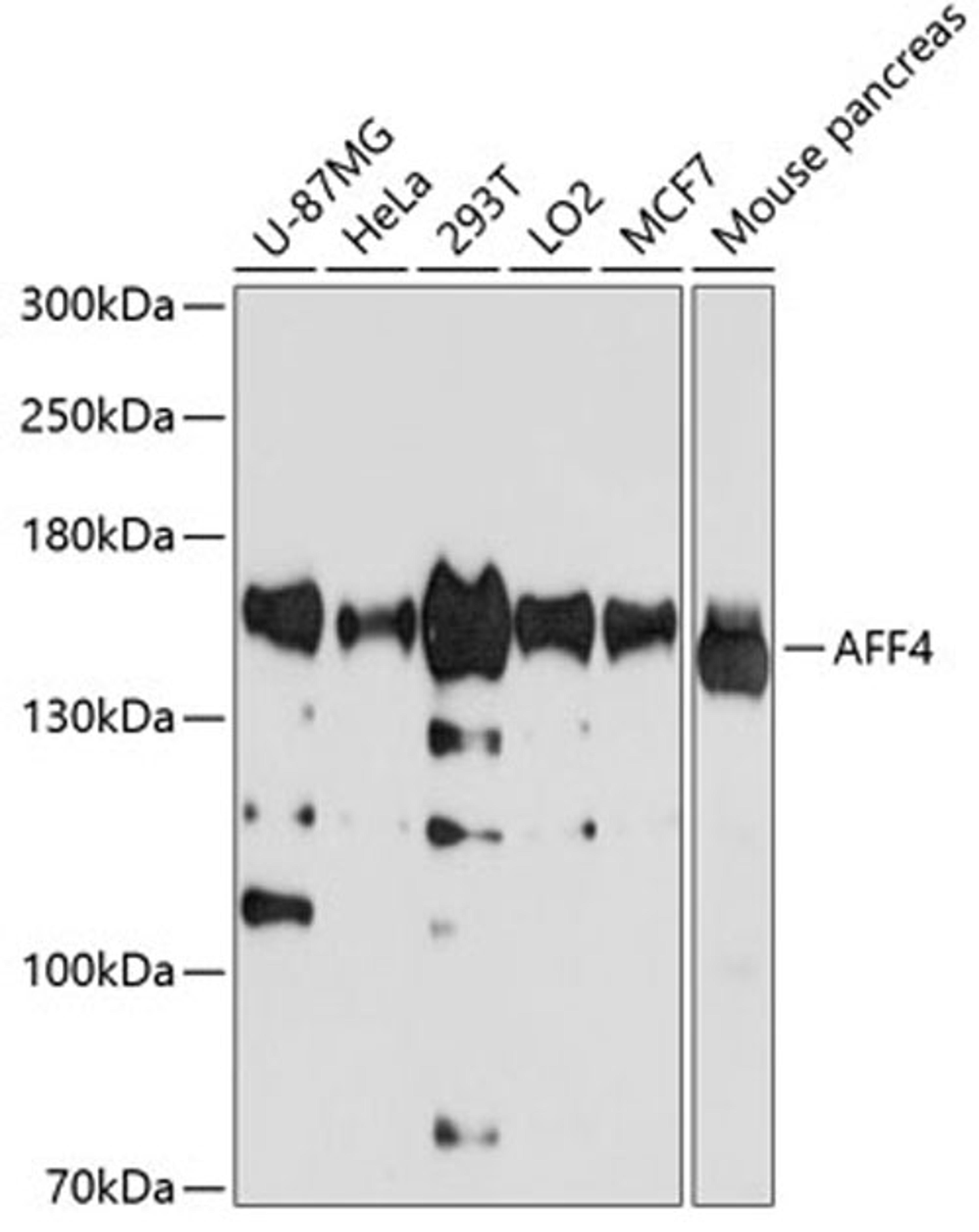 Western blot - AFF4 antibody (A4644)