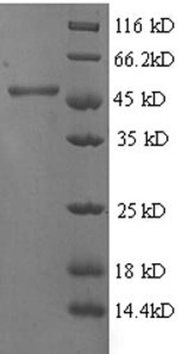 (Tris-Glycine gel) Discontinuous SDS-PAGE (reduced) with 5% enrichment gel and 15% separation gel.