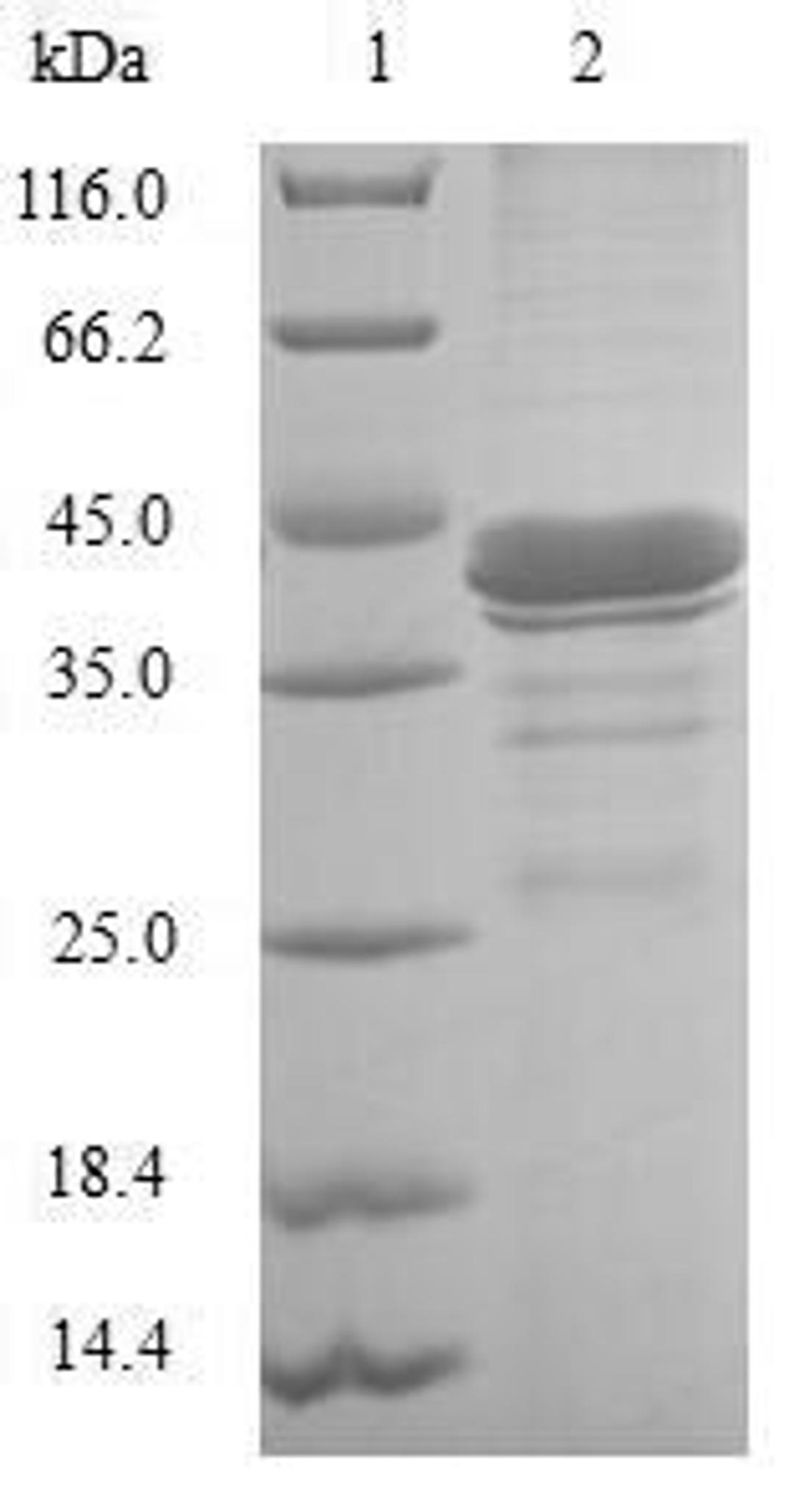 (Tris-Glycine gel) Discontinuous SDS-PAGE (reduced) with 5% enrichment gel and 15% separation gel.