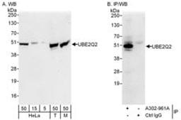 Detection of human and mouse UBE2Q2 by western blot (h&m) and immunoprecipitation (h).