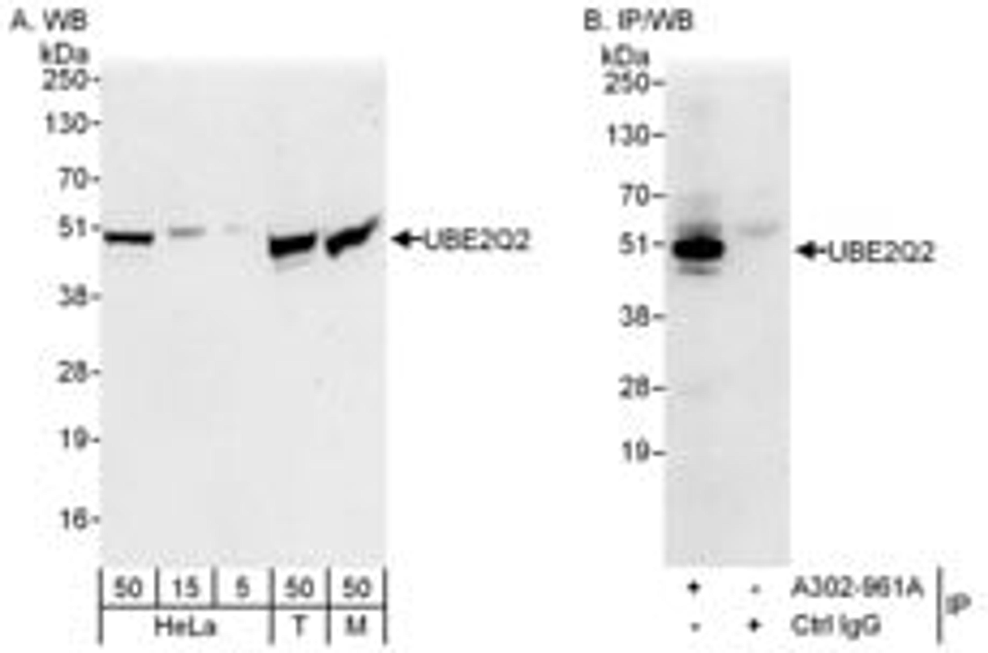 Detection of human and mouse UBE2Q2 by western blot (h&m) and immunoprecipitation (h).