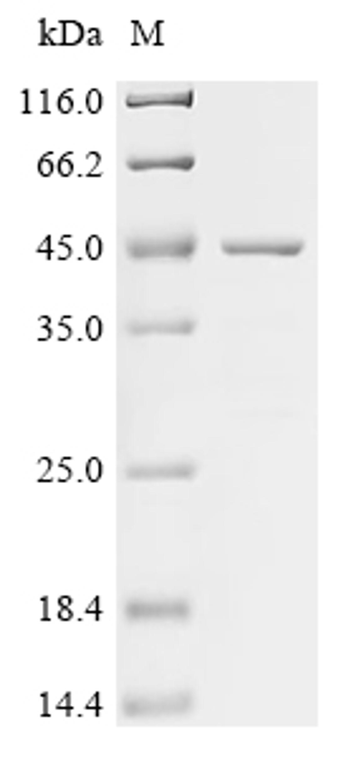 (Tris-Glycine gel) Discontinuous SDS-PAGE (reduced) with 5% enrichment gel and 15% separation gel.