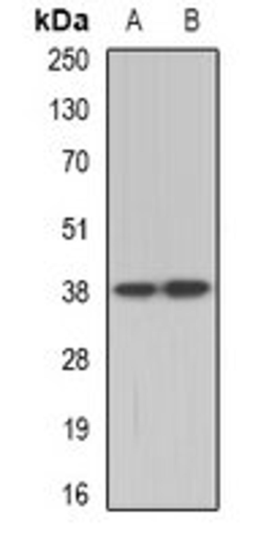 Western blot analysis of A431 (Lane1), Hela (Lane2) whole cell lysates using ETV7 antibody