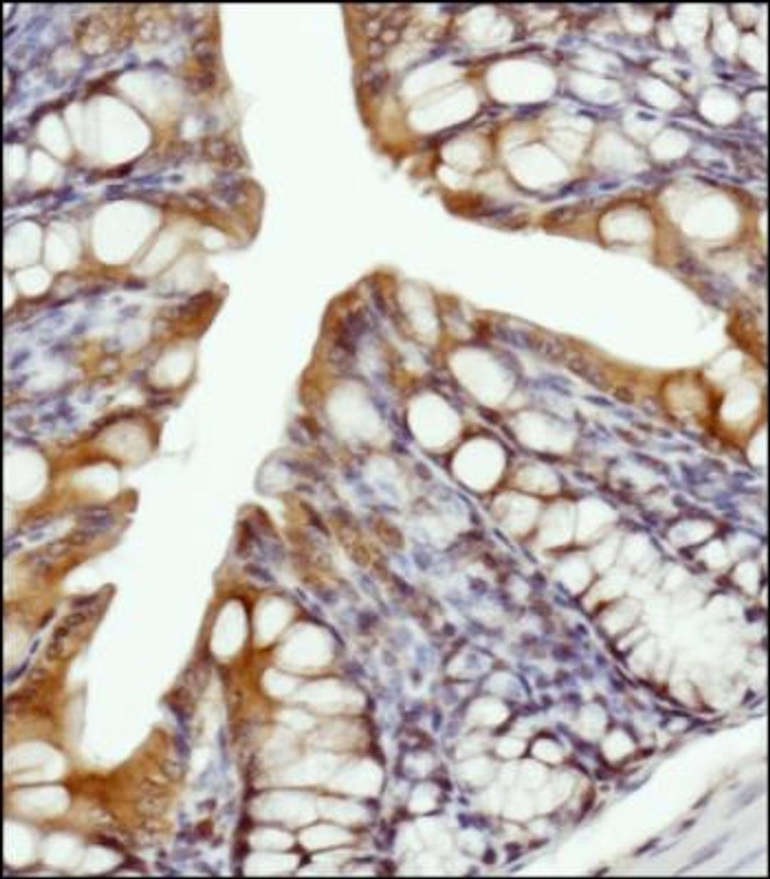 Immunohistochemistry-Paraffin: LSP1 Antibody [NBP1-74048] - IHC analysis of LSP1 in mouse colon tissue. Abundant membrane staining is visible in the epithelial cells.