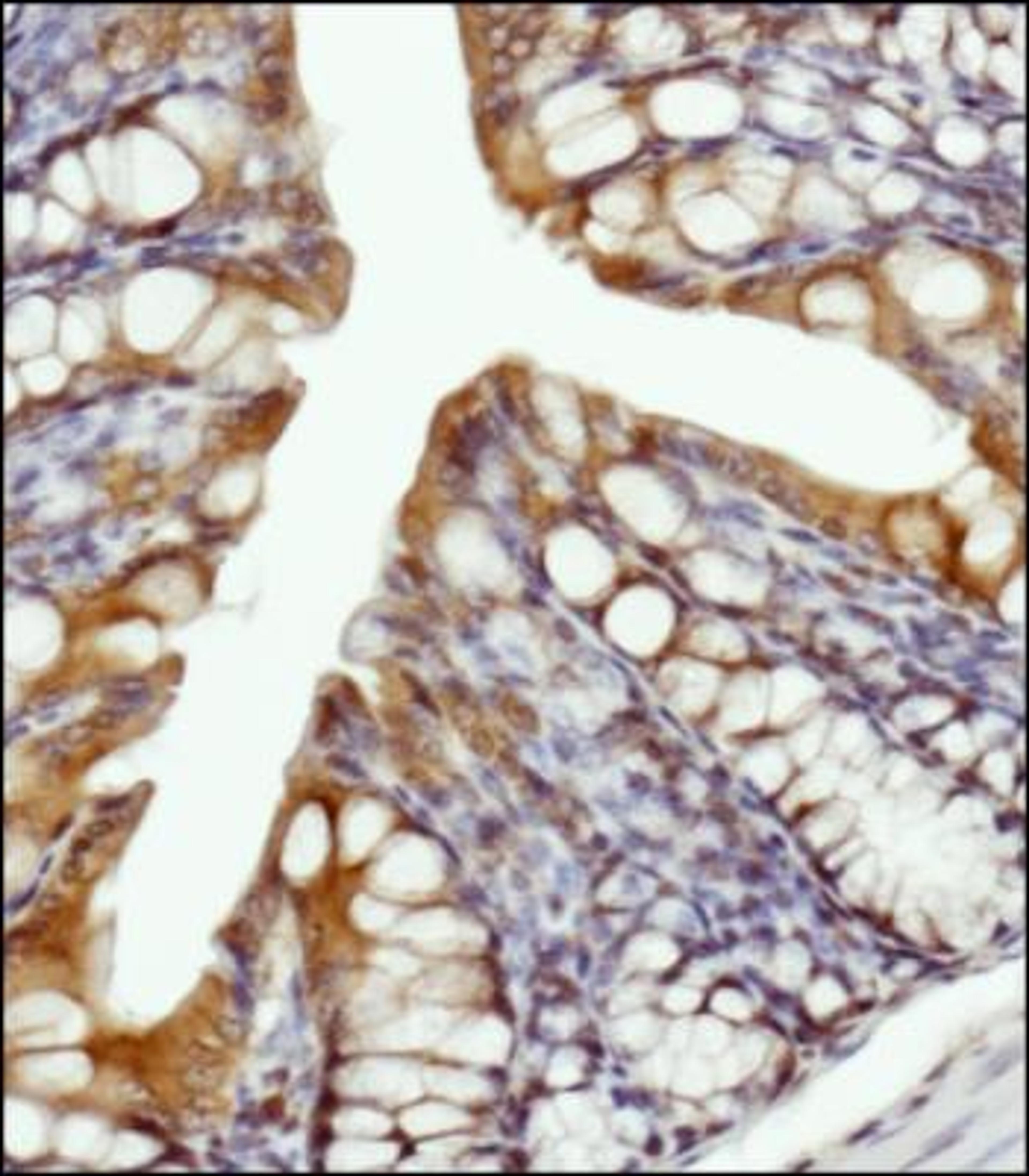 Immunohistochemistry-Paraffin: LSP1 Antibody [NBP1-74048] - IHC analysis of LSP1 in mouse colon tissue. Abundant membrane staining is visible in the epithelial cells.