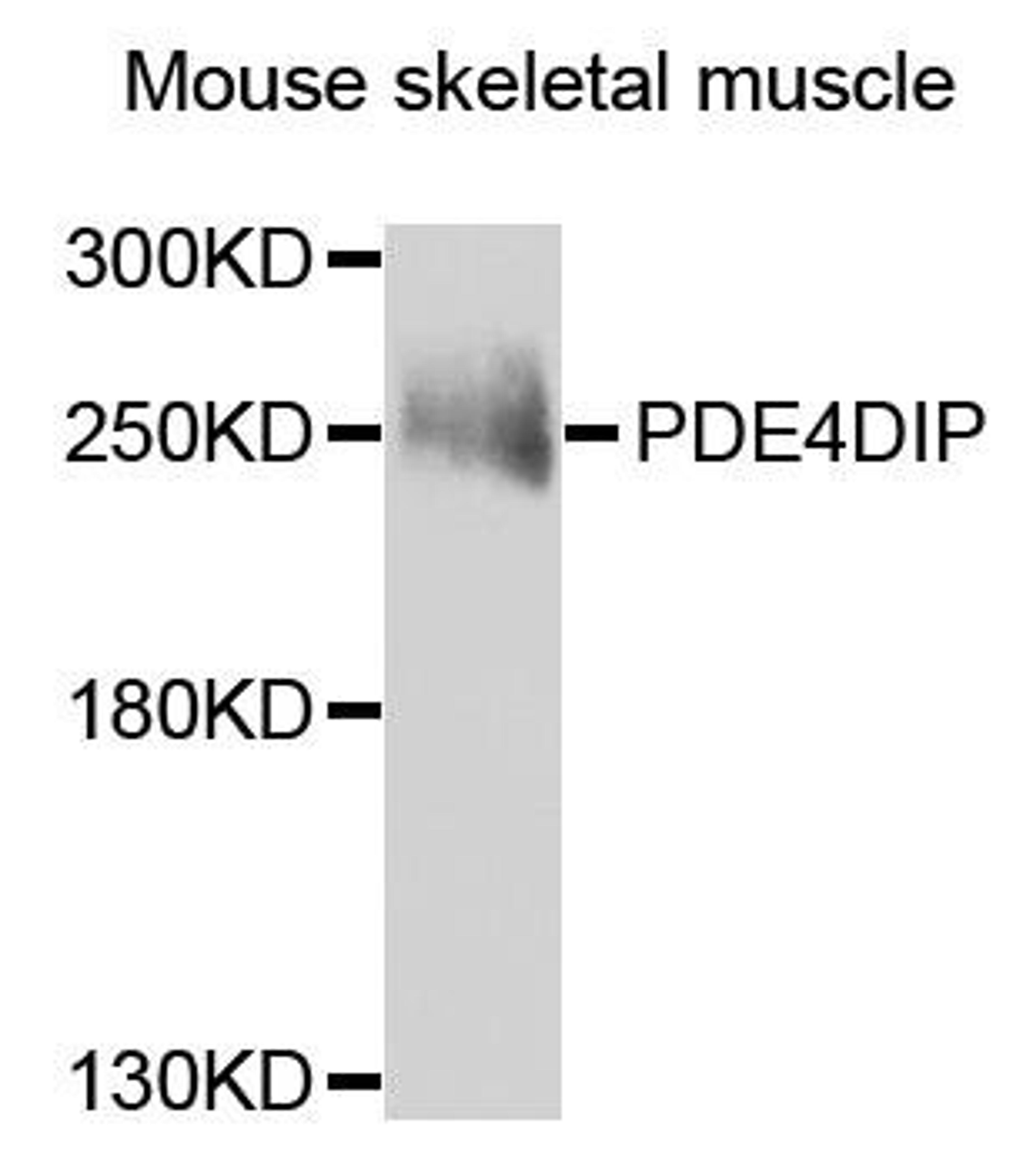 Western blot analysis of extracts of mouse skeletal muscle using PDE4DIP antibody