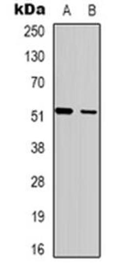 Western blot analysis of SH2D2A expression in MDAMB435 (Lane 1), HepG2 (Lane 2) whole cell lysates using SH2D2A antibody