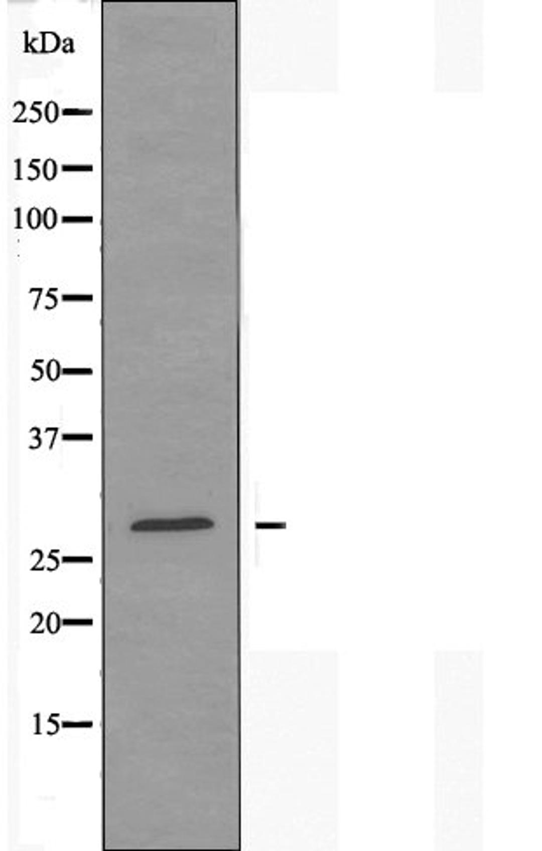 Western blot analysis of K562 cells and COS-7 cells using 42066 antibody