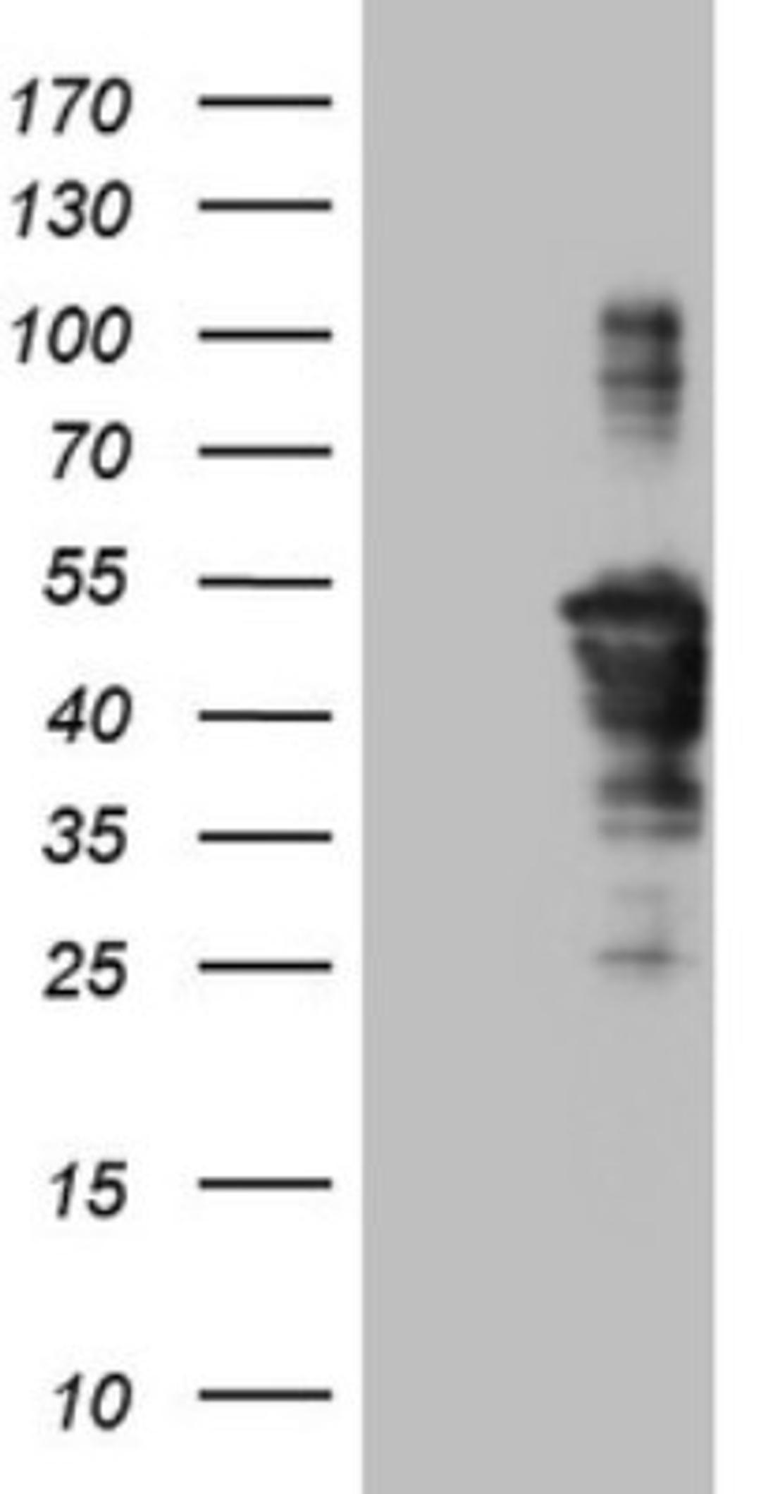 Western Blot: TCP10 Antibody (2C2) [NBP2-46090] - Analysis of HEK293T cells were transfected with the pCMV6-ENTRY control (Left lane) or pCMV6-ENTRY TCP10.