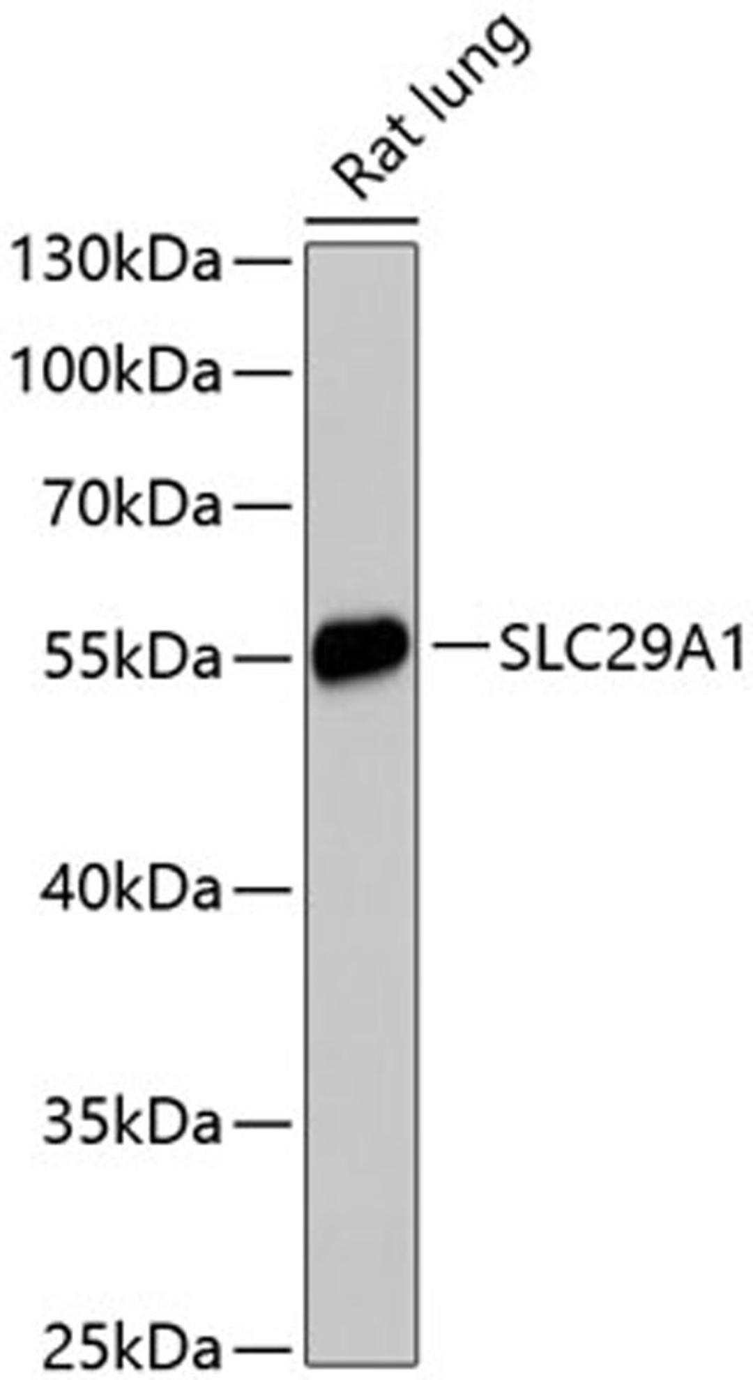 Western blot - SLC29A1 antibody (A13205)