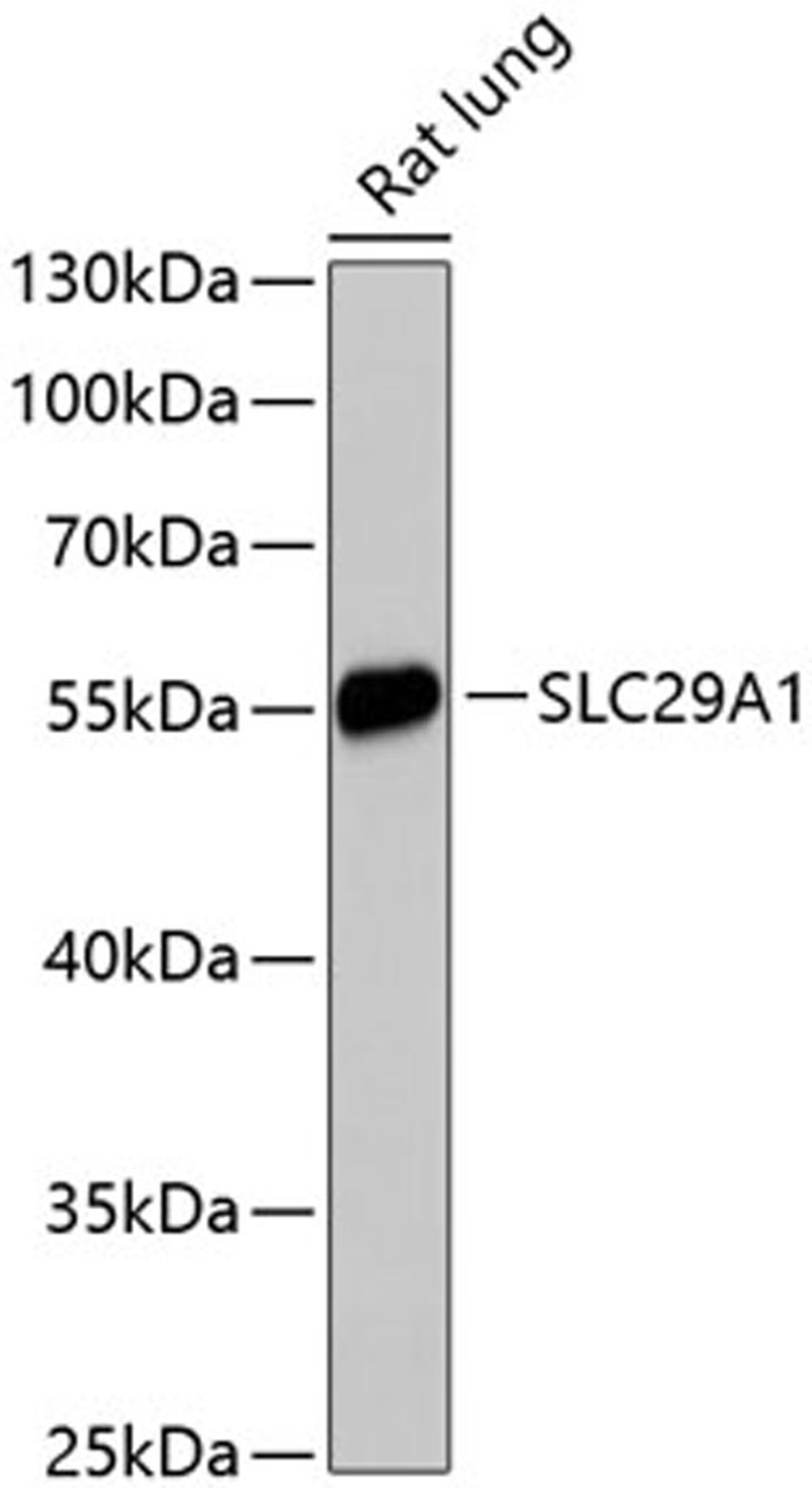 Western blot - SLC29A1 antibody (A13205)