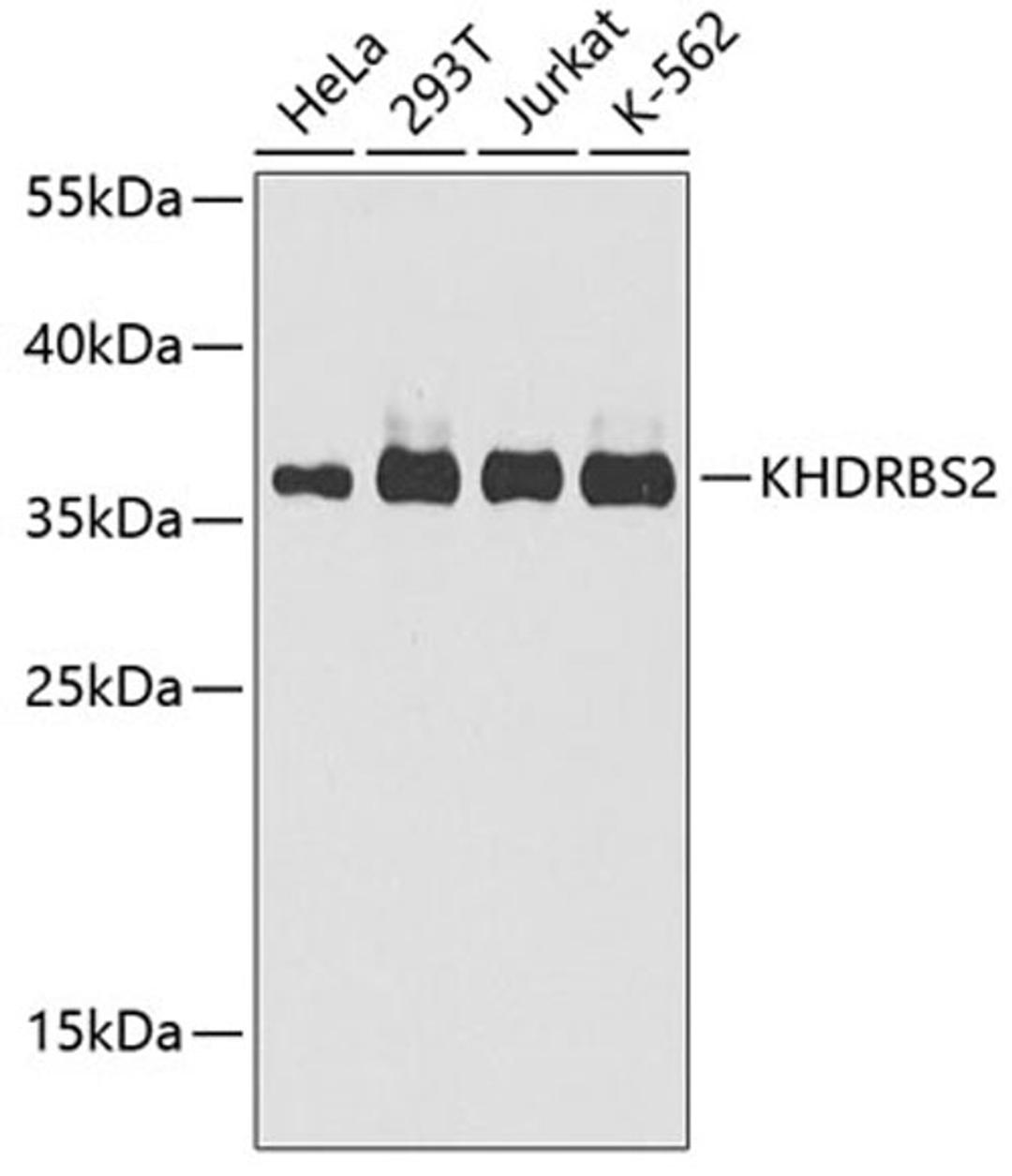 Western blot - KHDRBS2 antibody (A6102)