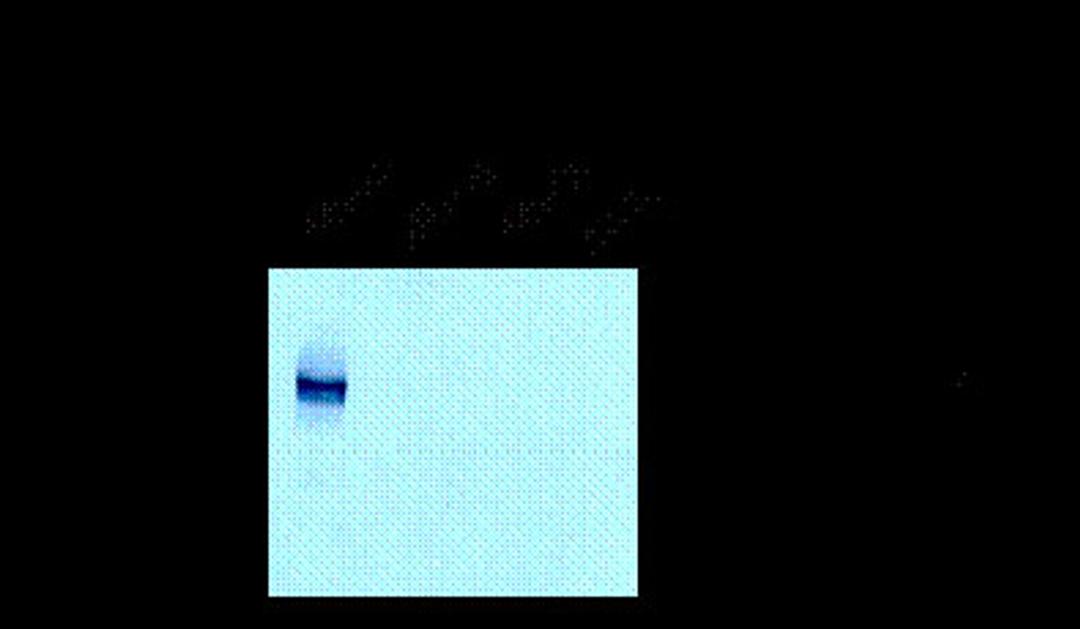 NMDA NR1, Splice Variant N1 Antibody