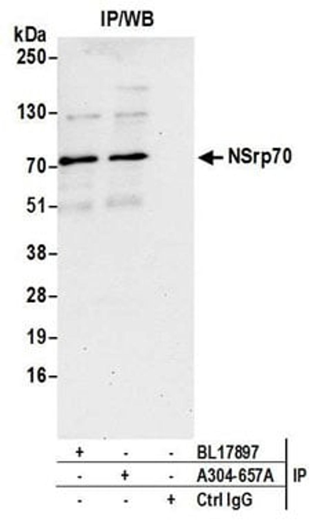 Detection of human NSrp70 by western blot of immunoprecipitates.