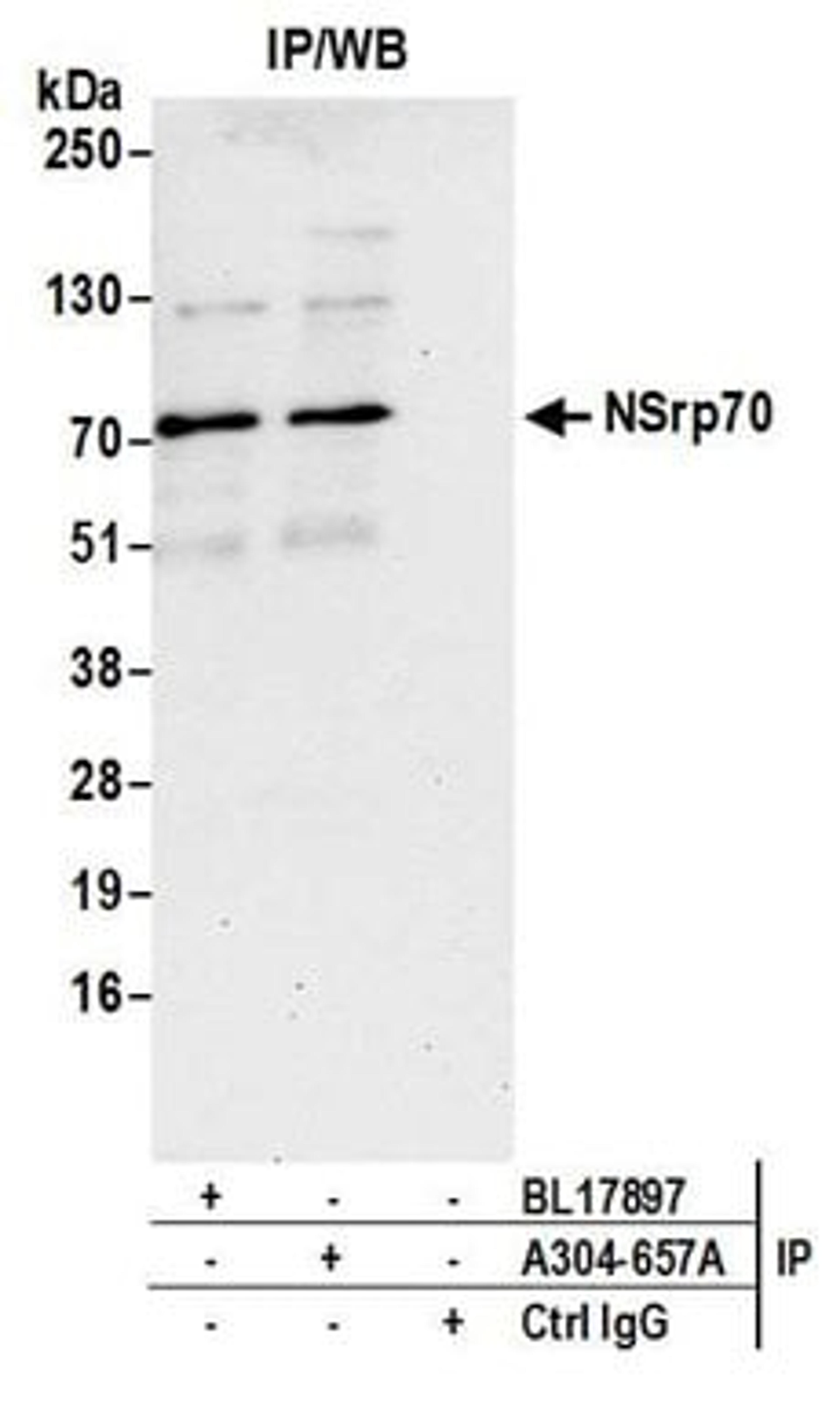 Detection of human NSrp70 by western blot of immunoprecipitates.