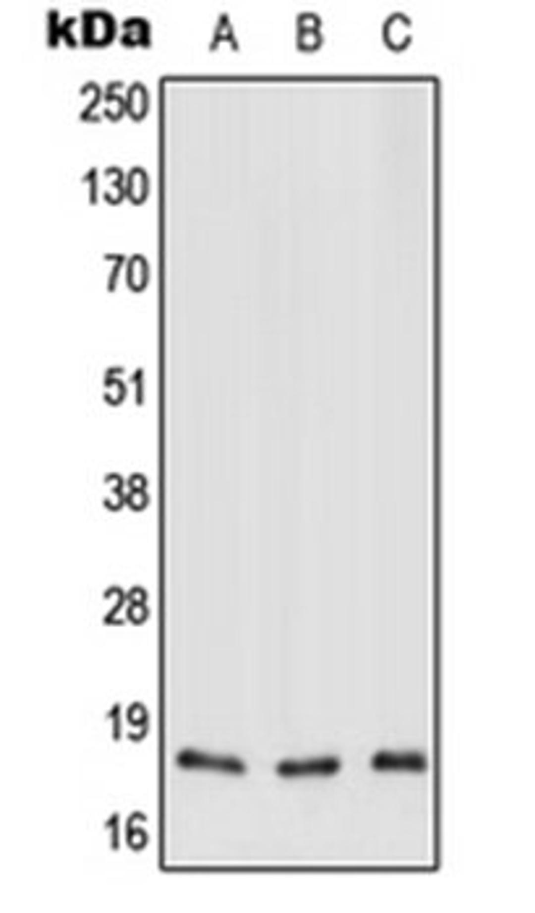 Western blot analysis of HEK293T (Lane 1), Raw264.7 (Lane 2), H9C2 (Lane 3) whole cell lysates using MT-ND3 antibody