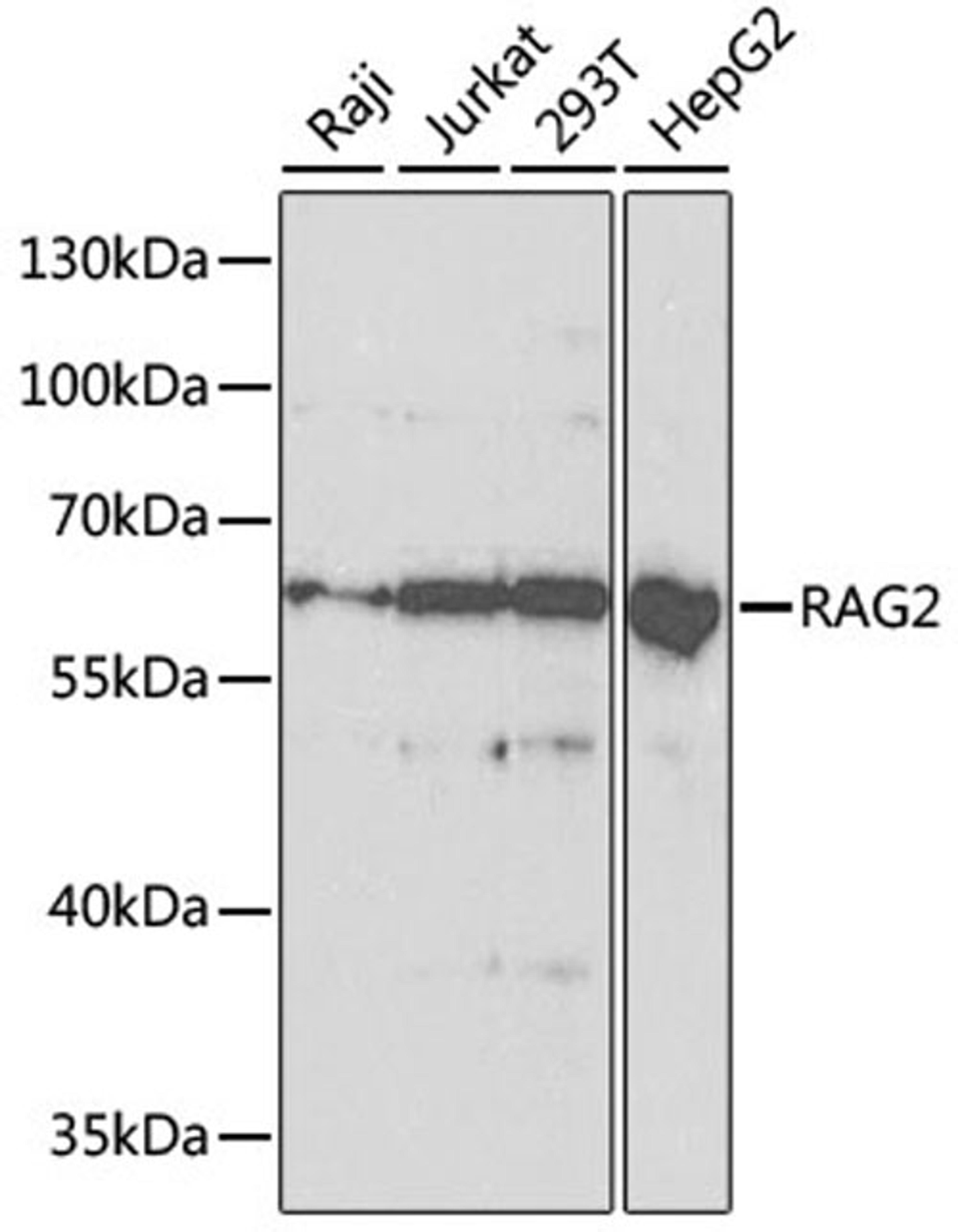 Western blot - RAG2 antibody (A5626)